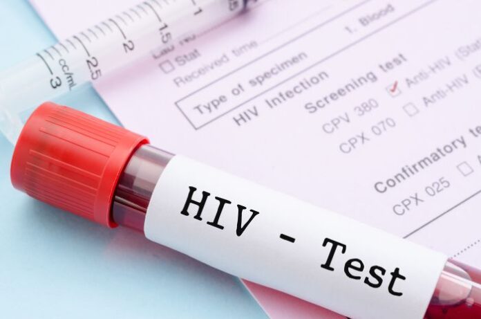 Testy na HIV - probówka z próbką krwi.
